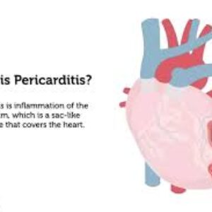 پریکاردیت قلبی چیست؟