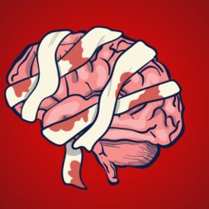 آسیب تروماتیک مغز